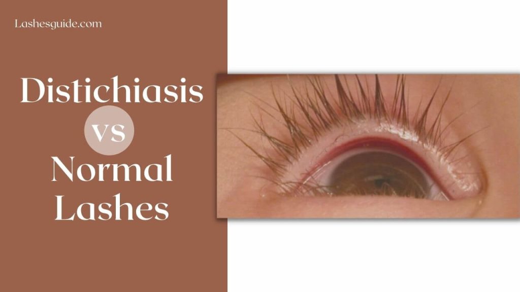 Distichiasis Vs Normal Lashes Lashes Guide