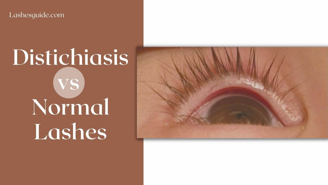 Distichiasis Vs Normal Lashes